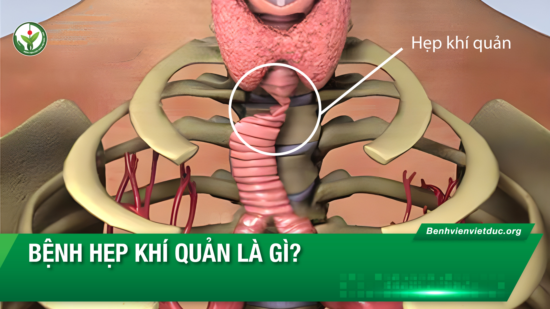 cấu trúc khí quản bình thường