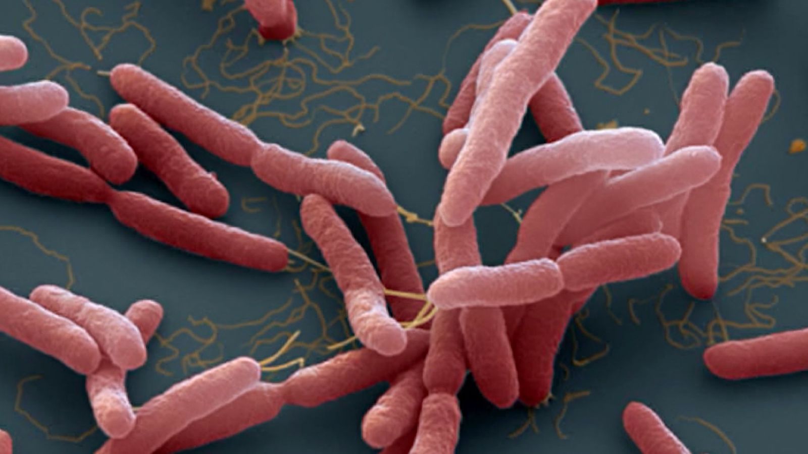 Vi khuẩn Burkholderia pseudomallei