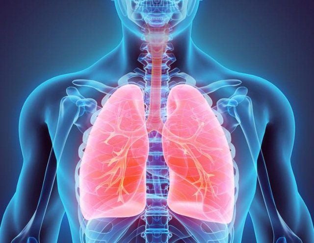 CT scan viêm phổi