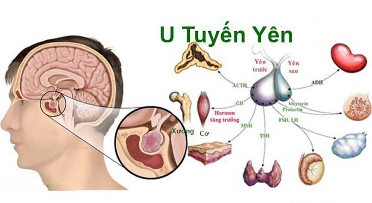 Tuyến yên trong não người
