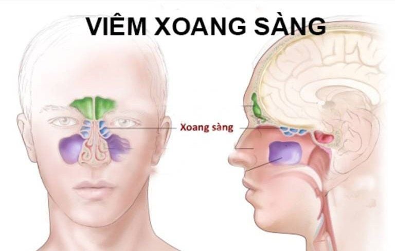 Vị trí xoang sàng