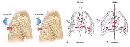 CT scan mảng sườn di động