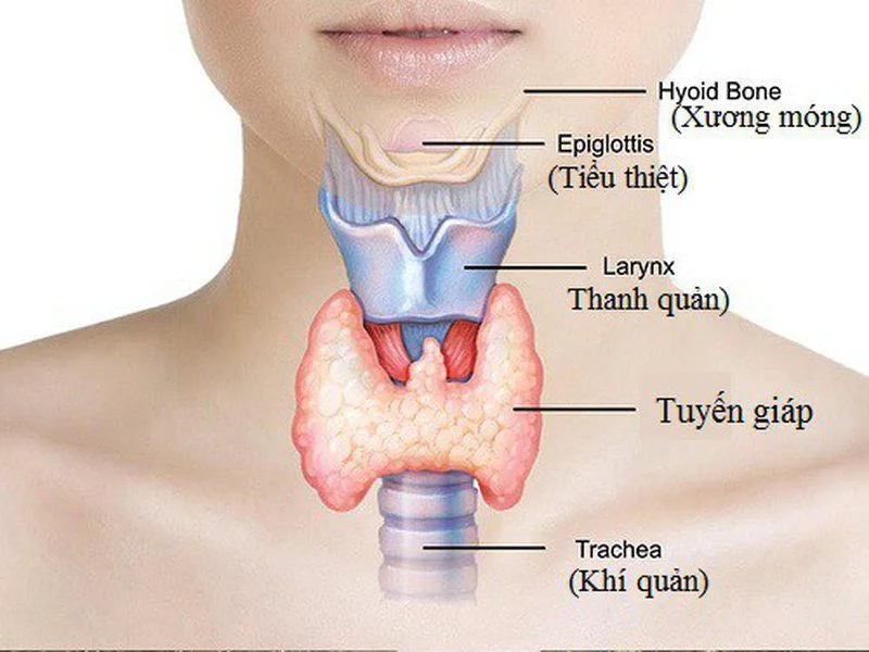 Viêm tuyến giáp im lặng: Nguyên nhân, triệu chứng và cách điều trị hiệu quả 7 Hình ảnh minh họa viêm tuyến giáp im lặng