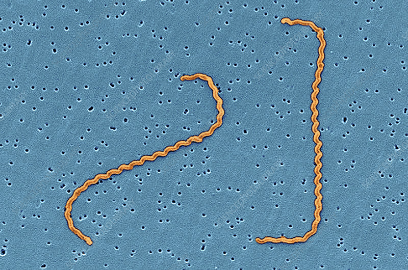 Chuột là nguồn lây chính của Leptospira