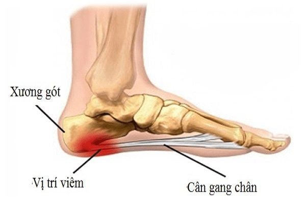 Cấu trúc cân gan chân