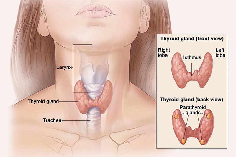Siêu âm tuyến giáp De Quervain