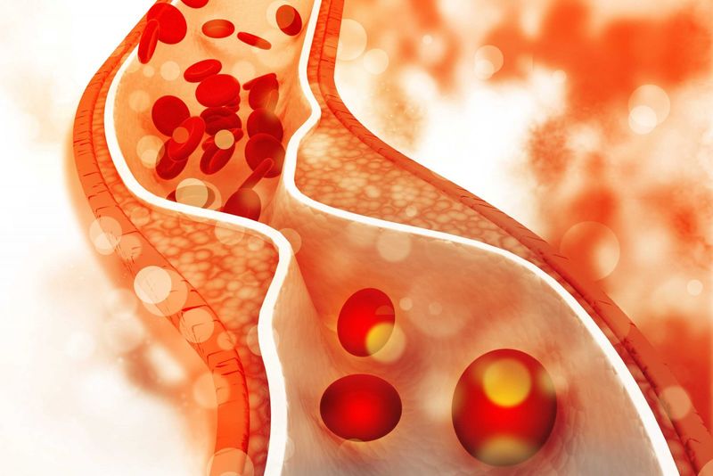 Phân loại cholesterol