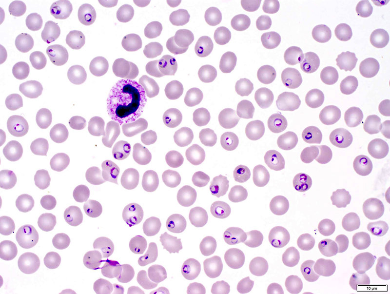 Ký sinh trùng sốt rét Plasmodium falciparum
