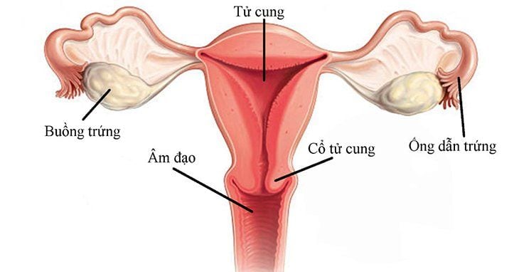 Hình ảnh chẩn đoán tử cung hình cung