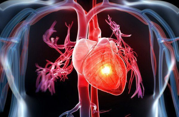 MRI tim trong amyloidosis