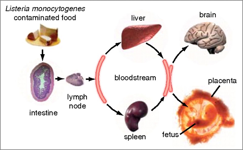 Vi khuẩn Listeria monocytogenes