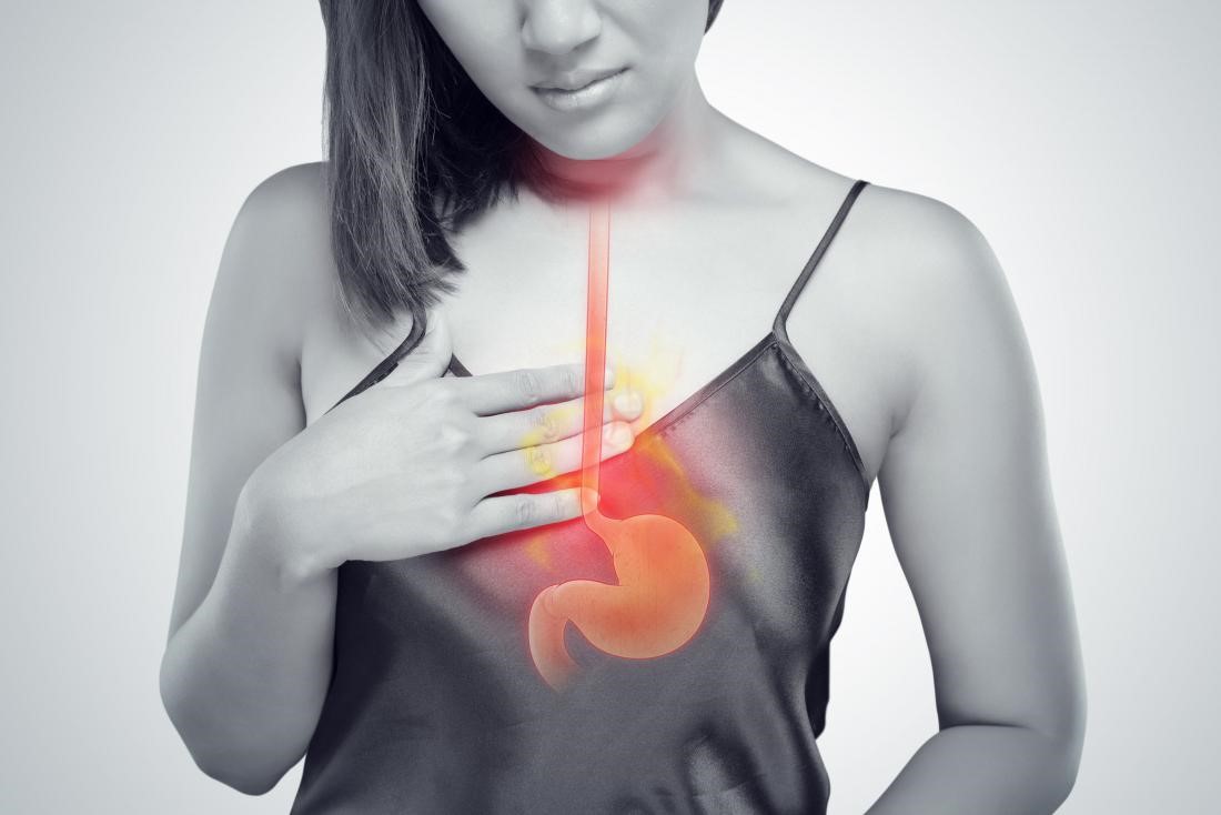 Ợ Nóng: Nguyên Nhân, Triệu Chứng và Cách Điều Trị Hiệu Quả 7 Triệu chứng ợ nóng và vùng ảnh hưởng