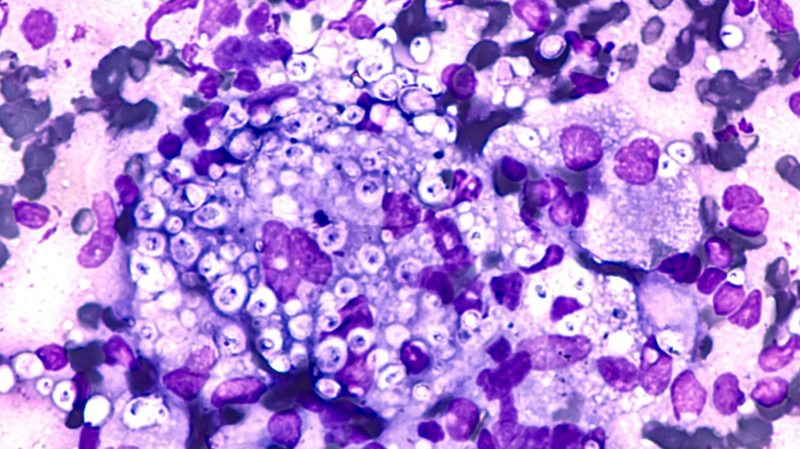 Hình ảnh nấm Histoplasma dưới kính hiển vi