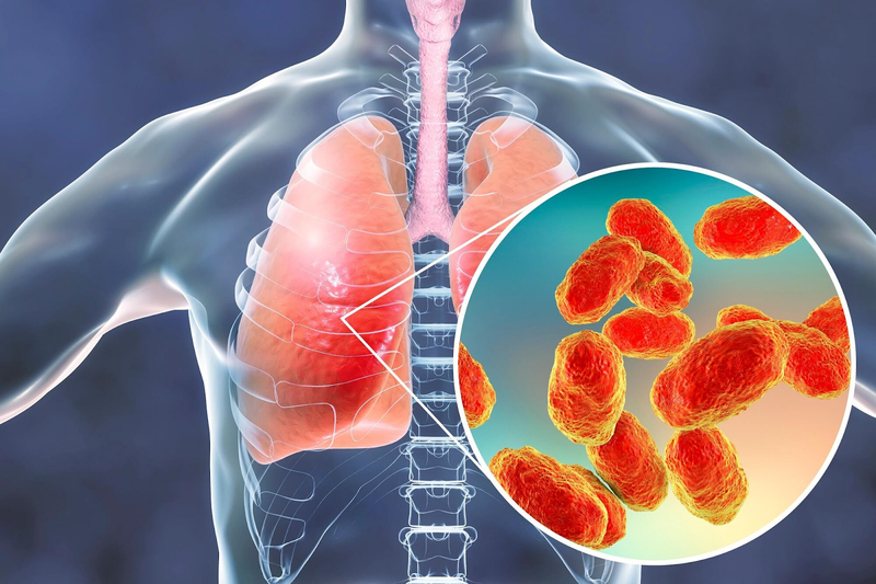 Xét nghiệm chẩn đoán Coccidioidomycosis