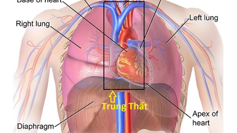 Xơ hóa trung thất - Medlatec