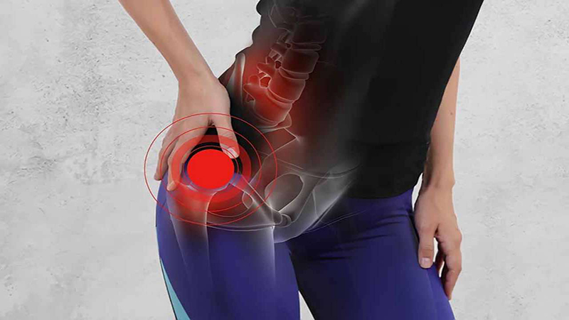 Viêm khớp mu gây đau vùng trên xương mu