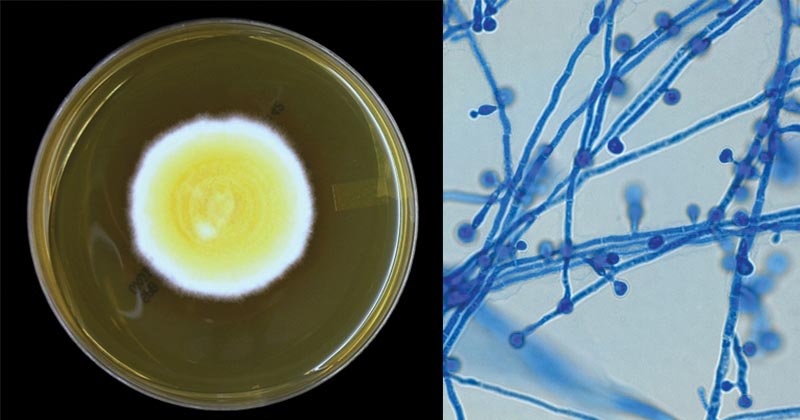 Hình ảnh nấm Blastomyces dermatitidis