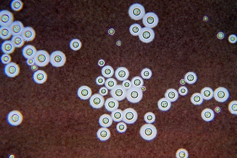 Nhiễm nấm Cryptococcus là gì? 7 Cryptococcus neoformans dưới kính hiển vi
