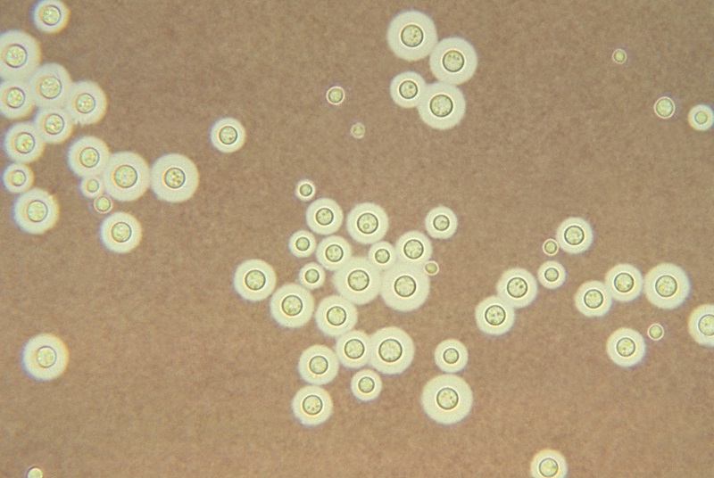Hình ảnh nấm Cryptococcus dưới kính hiển vi