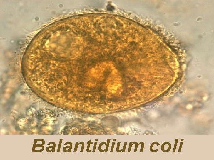 Viêm Ruột do Balantidium coli: Nguyên Nhân, Triệu Chứng và Cách Điều Trị 8 Balantidium coli dưới kính hiển vi