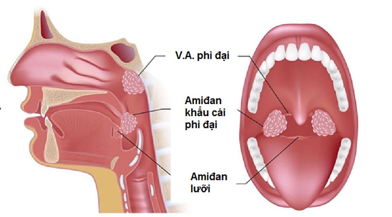 Vị trí và cấu trúc VA