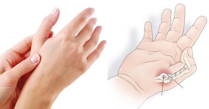 Hình ảnh viêm gân qua siêu âm