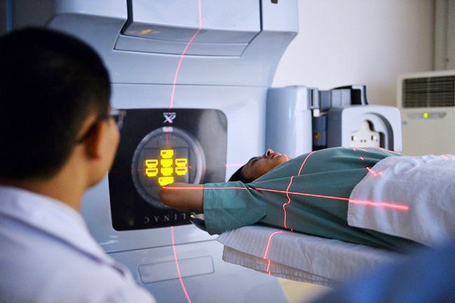 Hình ảnh chụp CT tổn thương phổi do xạ trị