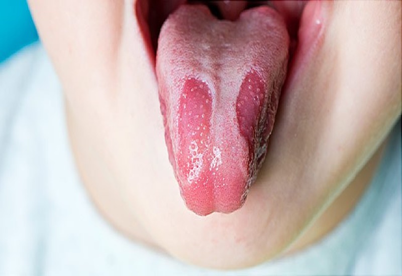 Hình ảnh tổng quan lưỡi bản đồ