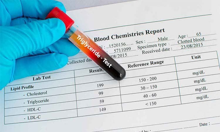 Triệu chứng tăng triglyceride máu