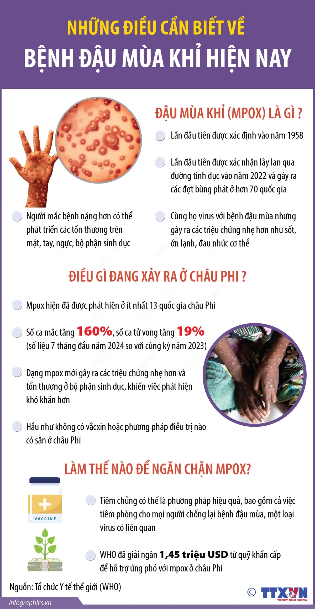 Đường lây truyền bệnh đậu mùa khỉ