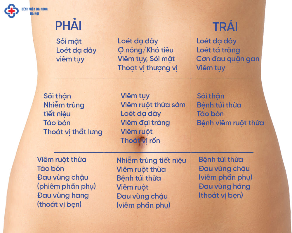 Bụng Chướng Lệch Một Bên: Nguyên Nhân, Dấu Hiệu và Cảnh Báo Bệnh Lý Nguy Hiểm 8 Chẩn đoán hình ảnh bụng chướng lệch