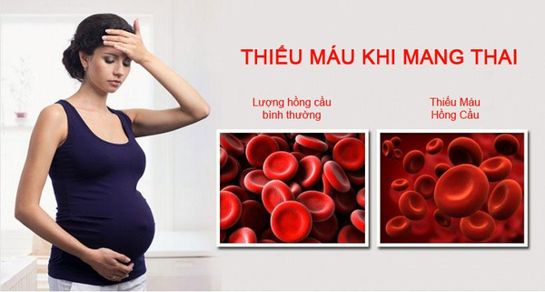 Bà bầu mệt mỏi