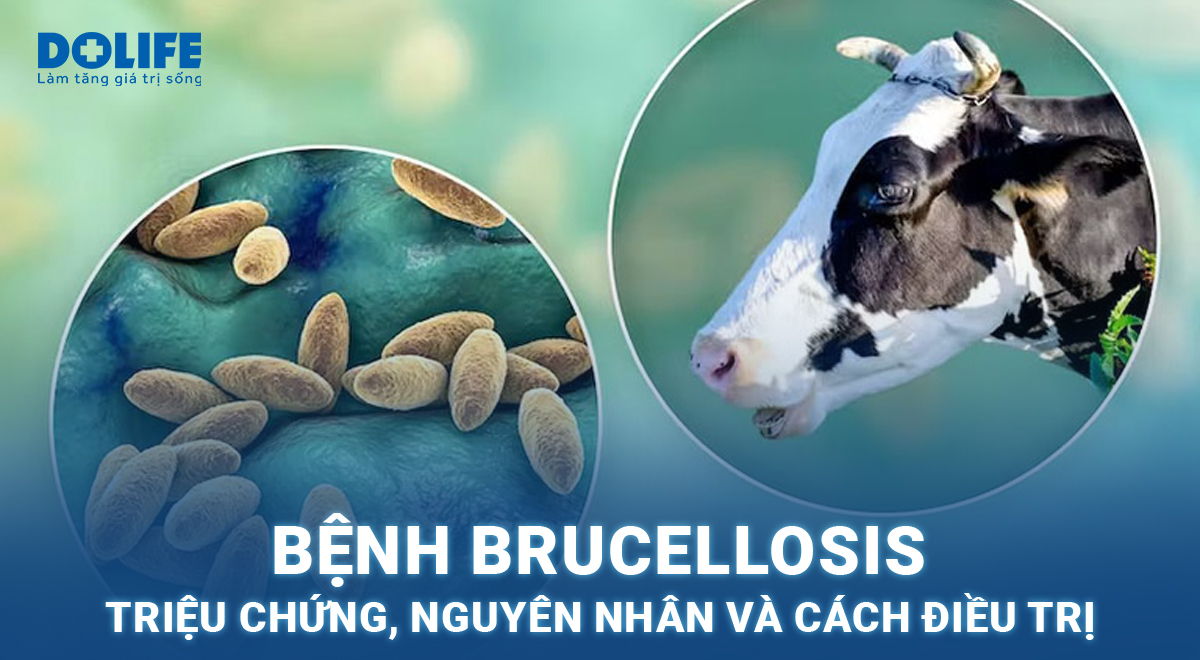 Bệnh Brucellosis (Sốt làn sóng): Nguyên nhân, triệu chứng và cách điều trị 8 Triệu chứng sốt làn sóng