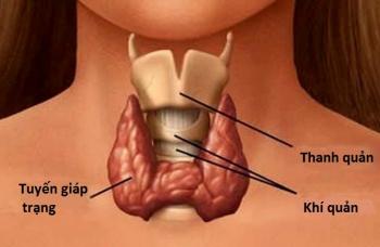 triệu chứng suy giáp sau mổ