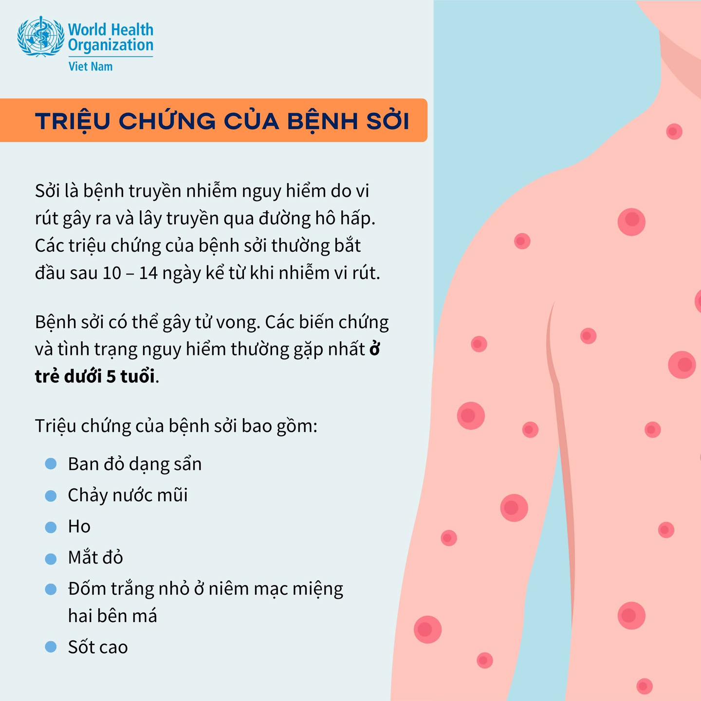 Phát ban sởi toàn thân