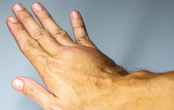 Dấu hiệu cục máu đông trên da