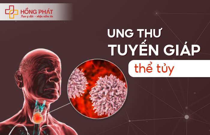 sơ đồ tuyến giáp ở người