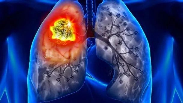 Bụi amiăng dưới kính hiển vi