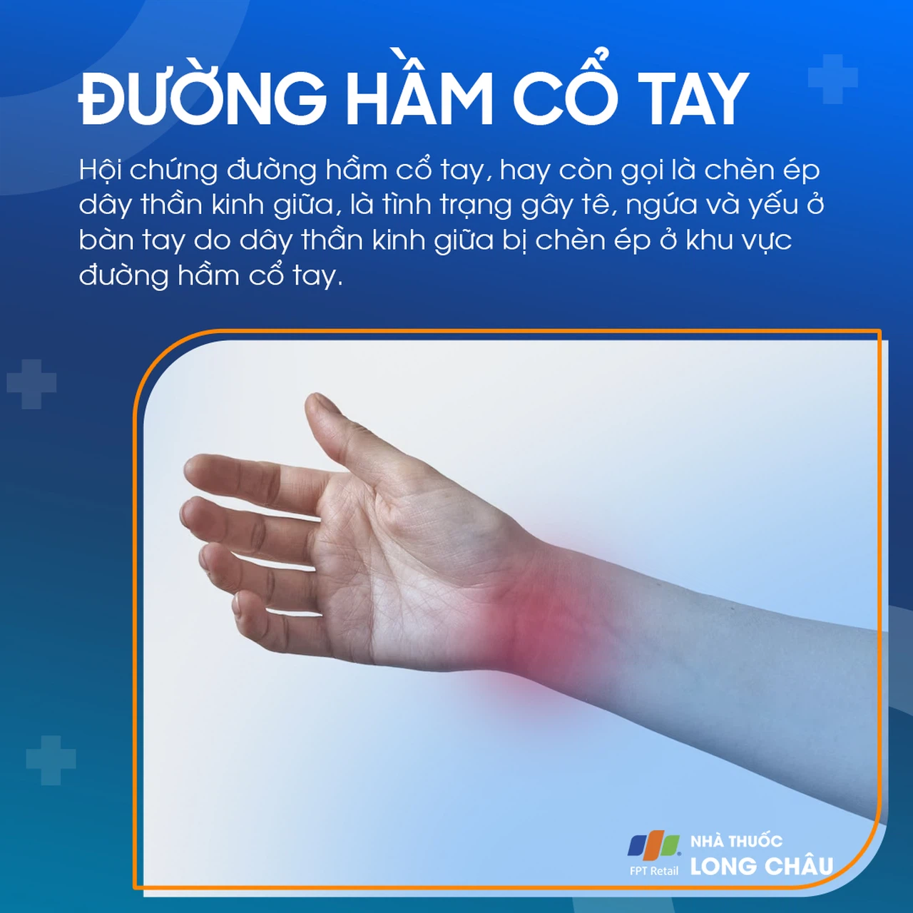 Cấu trúc đường hầm cổ tay