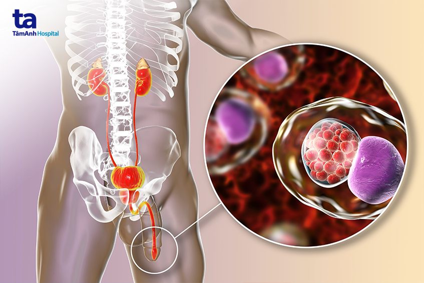Chlamydia phổ biến ở người trẻ
