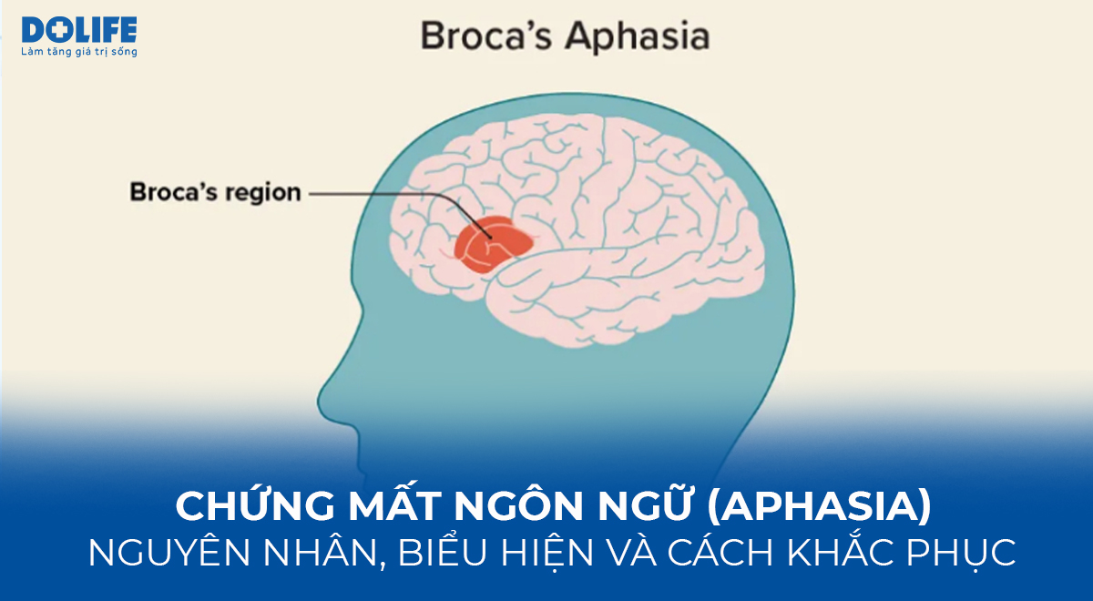 phục hồi chức năng apraxia