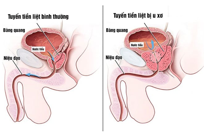 soi-bang-quang.jpg