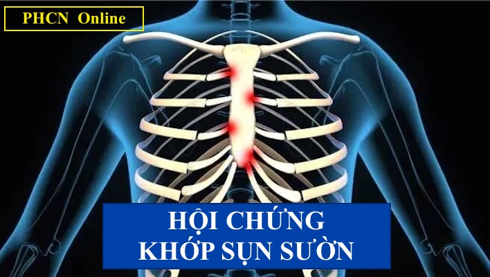 Chẩn đoán viêm sụn sườn bằng MRI và siêu âm