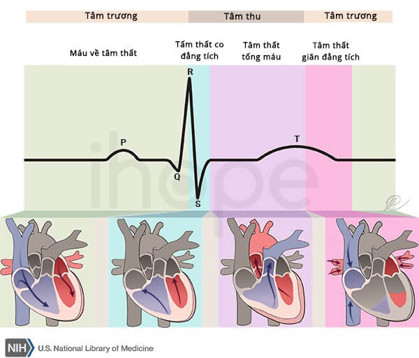 Điện tâm đồ trong hội chứng QT ngắn