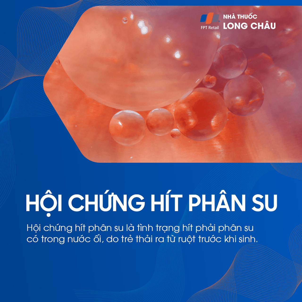 Biểu hiện của hội chứng hít phân su
