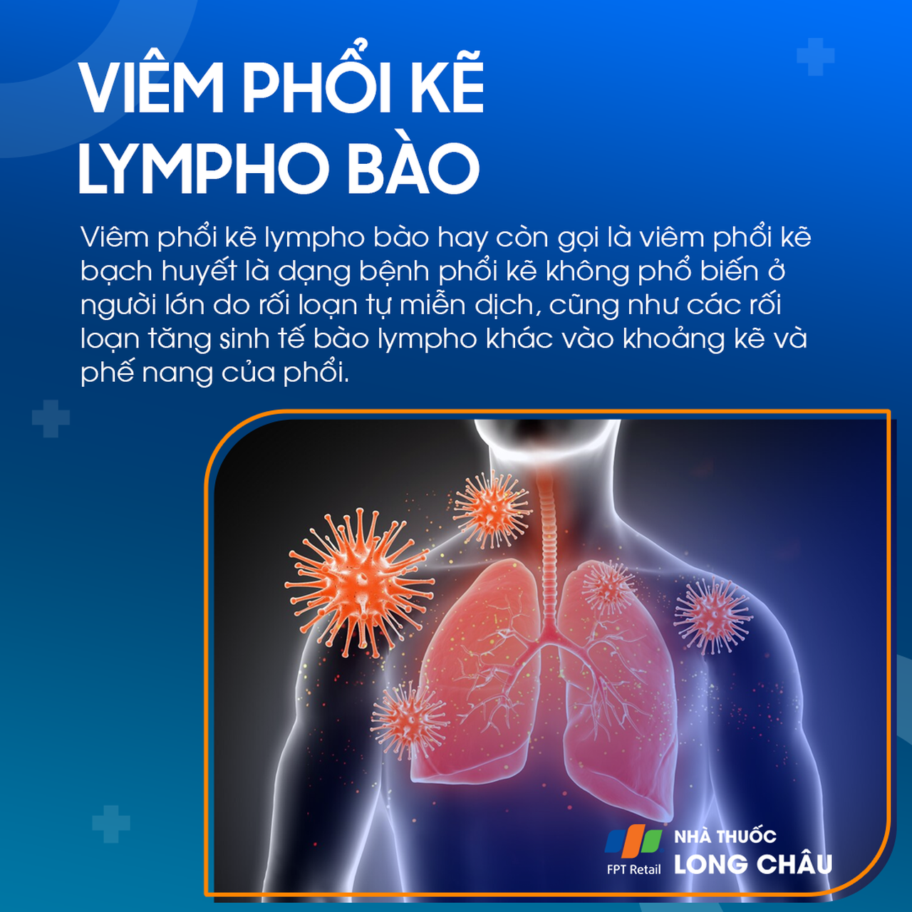 Ảnh minh họa viêm phổi kẽ lympho bào