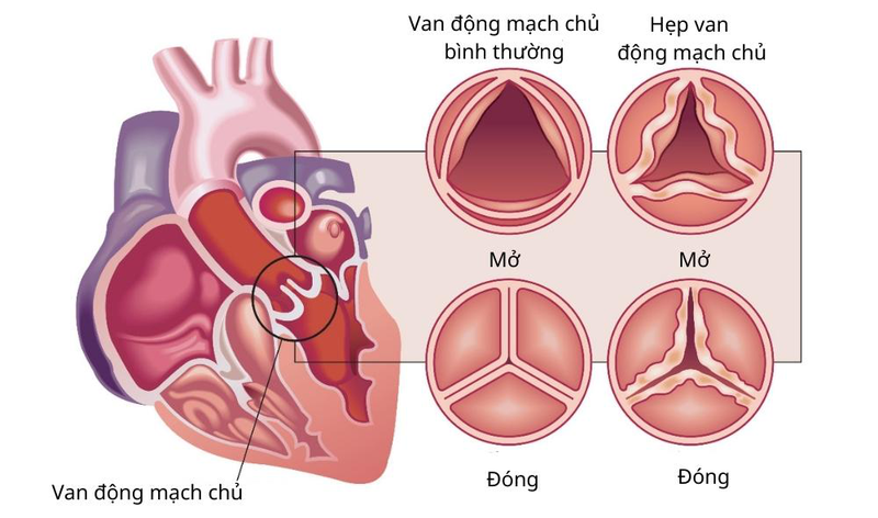 Cấu tạo van tim
