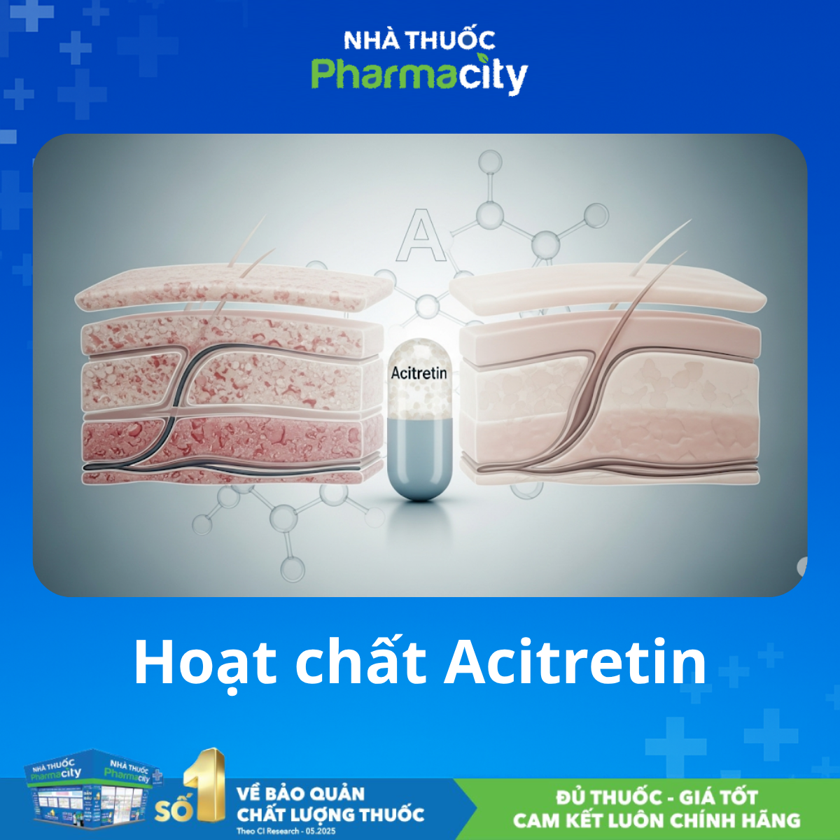 Acitretin điều trị vảy nến