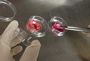 Quy trình xử lý mô buồng trứng tại phòng lab
