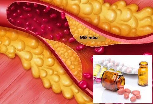 Thực phẩm tăng cholesterol